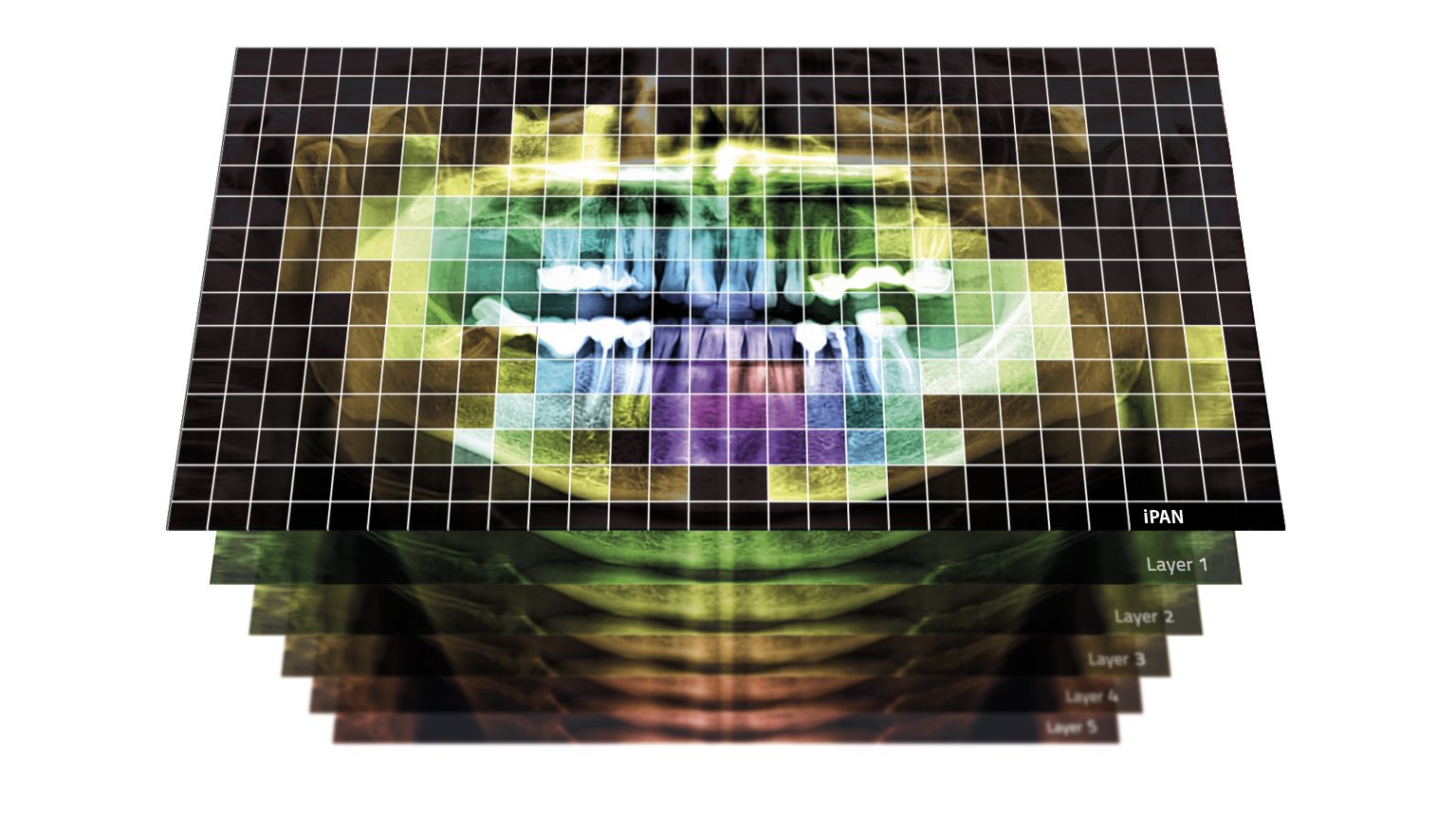 iPAN Best Focus MyRay_1080x608
