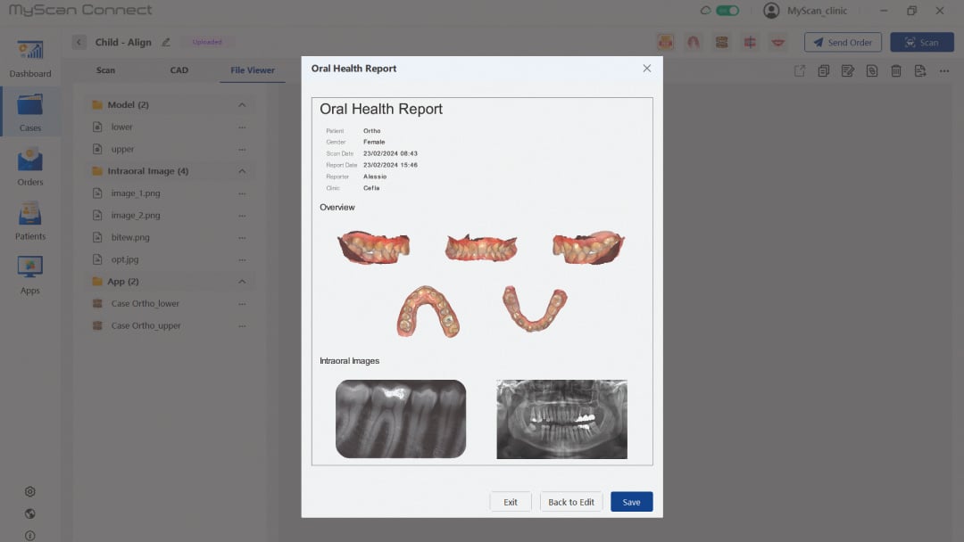 MyScan WL Wireless Intraoral Scanner | MyRay