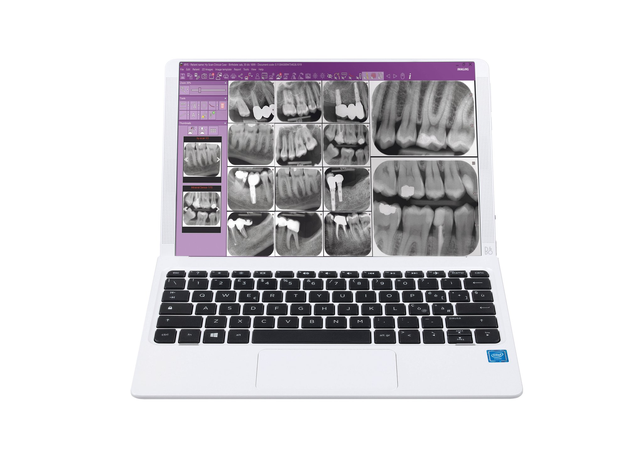 Particolari Myray_333590M