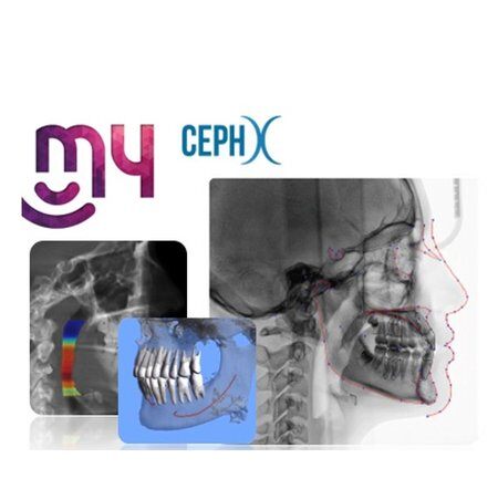 ceph.jpg__450x450_q85_subsampling-2