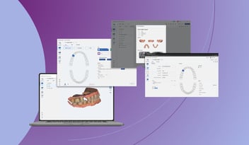 digital dental workflow