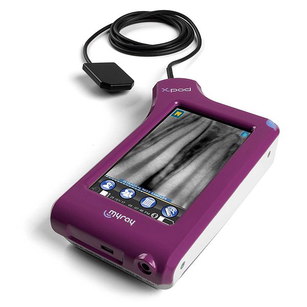 Scanner odontoiatrico portatile X Pod